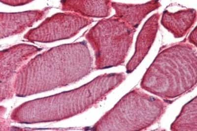 Immunohistochemistry-Paraffin: VRL1 Antibody [NBP3-14517]